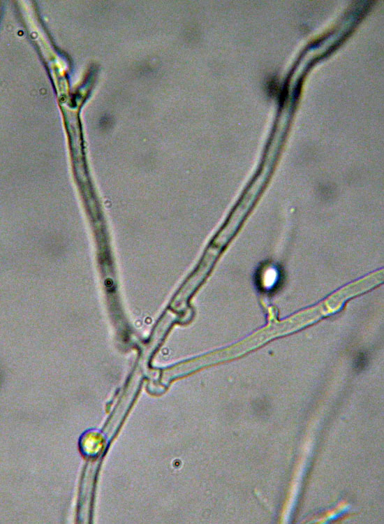 In parcheggio (Granulobasidium vellereum)